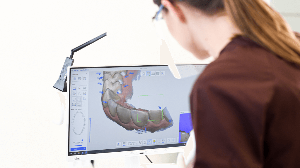 Periodontitas: simptomai ir faktai, kodėl nereikia bijoti jo gydymo