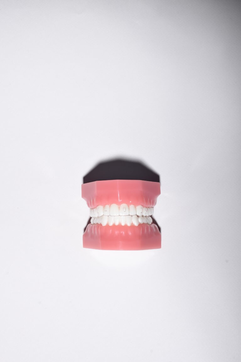 Maintenance memo for aesthetic fillings
