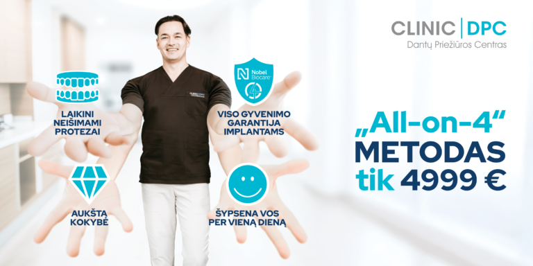 „All-on-4“ implantacija dabar tik 4999 EUR – nepraleiskite progos!